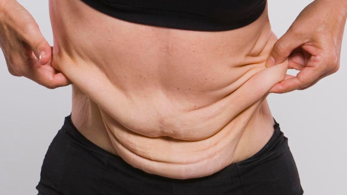 Cirurgia reparadora e planos de saúde: